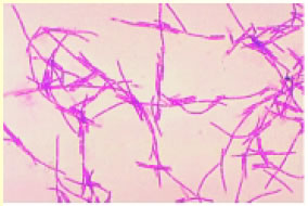 Βακτήρια άνθρακα