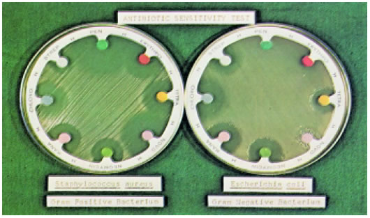 Εικόνα 1.17: Στα δύο τρυβλία με καλλιέργειες βακτηρίων δεν παρατηρείται αύξηση των βακτηρίων γύρω από τους χρωματισμένους δίσκους που περιέχουν αντιβιοτικά.