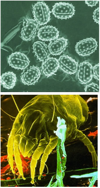 Εικόνα 1.30: Αλλεργιογόνα: γυρεόκοκκοι, άκαρι