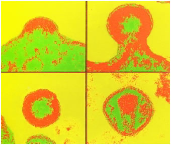 Eικόνα 1.34: Έξοδος ιού HIV από κύτταρο