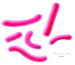 Εικόνα 1.6: Vibrio cholerae, το βακτήριο που προκαλεί χολέρα.