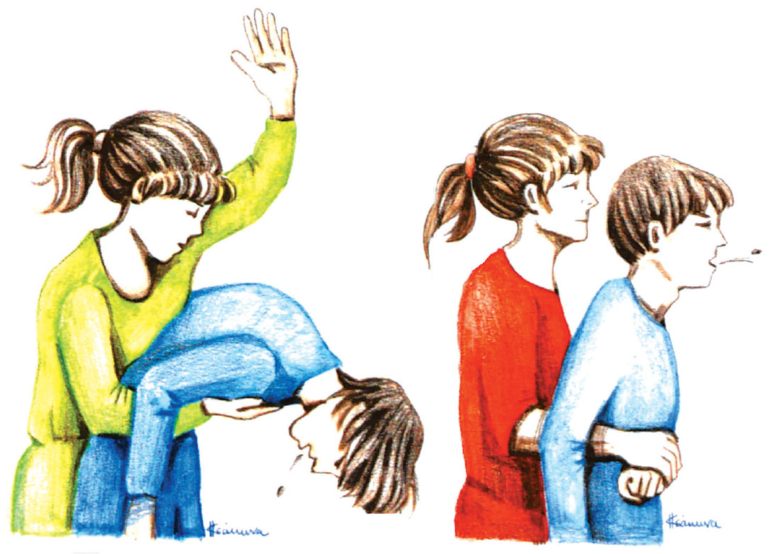 εικ. 5.6 Τεχνικές σε περίπτωση απόφραξης της