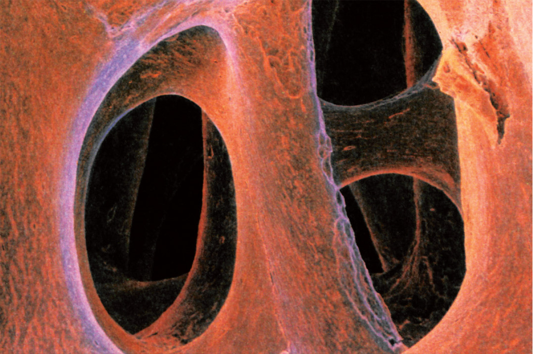 εικ. 7.3 Μυελοκυψέλες